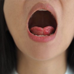 Close-up of a woman with a tongue tie